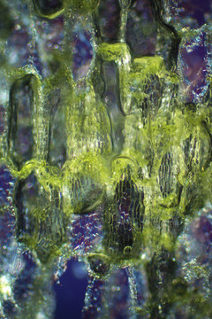 Micrograph abstract of cells in skunk cabbage leaf, polarized.
