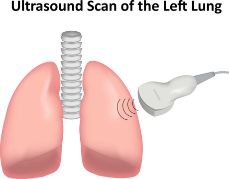 Ultrasound Scan Of The Lung