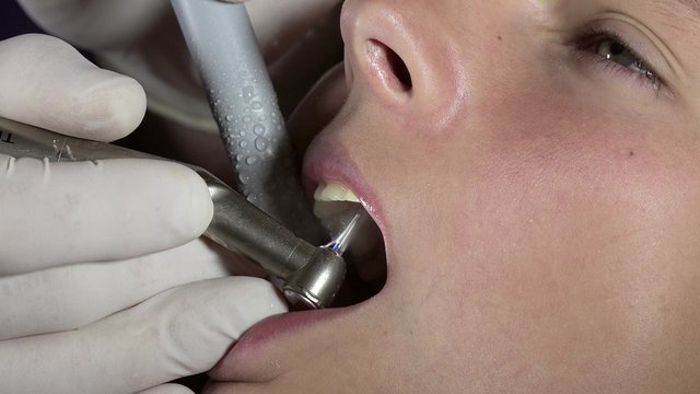 dentist uses its turbine