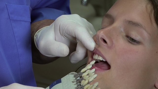 Choosing the color of teeth