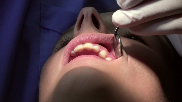 dentist practice a surface anesthesia