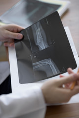 Obraz premium Doctor examining an elbow x-ray