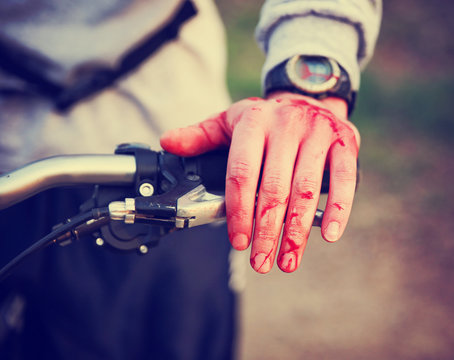 A Mountain Biker Cyclist With Blood All Over His Hands From Wreck