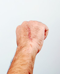  Wounded male hand by knife