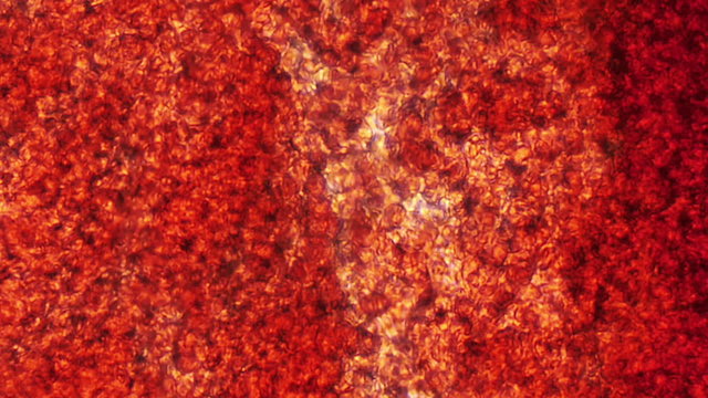 Blood Capillaries Seen at 600x Magnification.