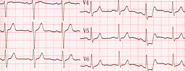 Cardiogram