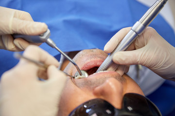 dentist hands treating male patient teeth