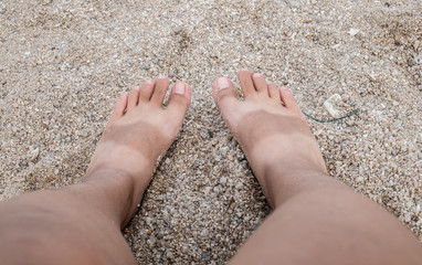 Sunburn on the feet, view from above
