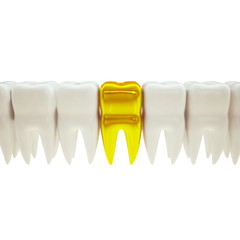 3d illustration of a row of teeth with gold tooth