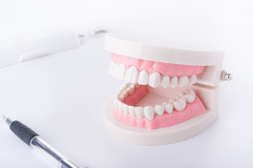 歯の模型,歯の定期検診