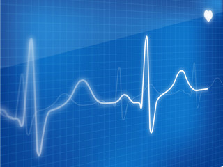 EKG waves