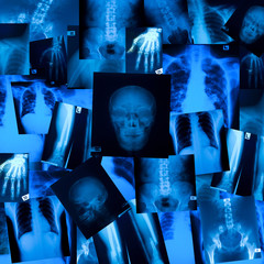 Obraz premium X ray film background