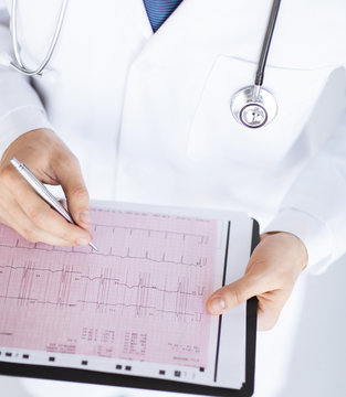 male doctor hands with cardiogram