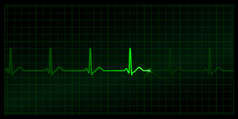 Cardiogram on the monitor. Green heartbeat line at black background. Vector medicine Illustration