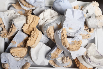 Pile of plaster models for dentures.