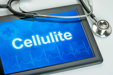 Tablet mit der Diagnose Cellulite auf dem Display