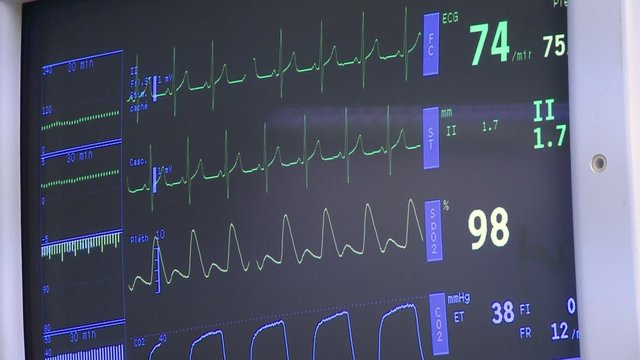 surgery in an operating room/permanent monitoring of vital function
