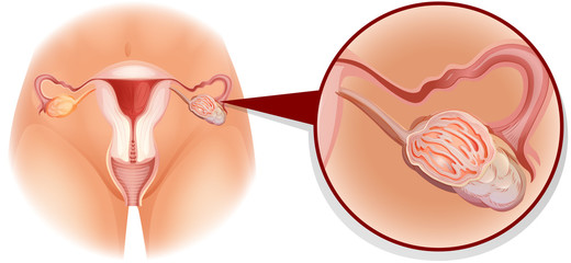 Overian diagram in detail