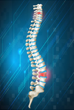 Human spine diagram on blue