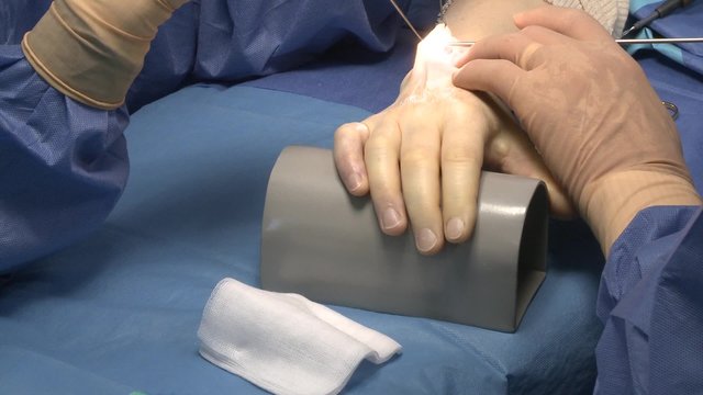 surgery in an operating room/cleaning contact endoscope lens
