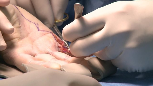 surgery in an operating room/Update defective tendon
