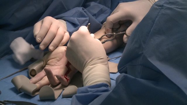 surgery in an operating room/placing a spacer clip
