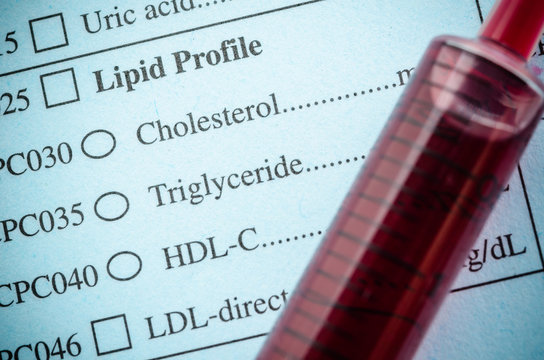 Medical check list Cholesterol, triglyceride and blood in synrin