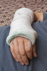 Plastered hand of man