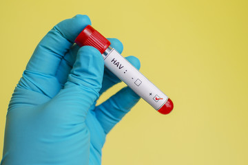 Fototapeta premium Hepatitis A virus (HAV) positive