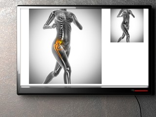 human bones radiography scan image