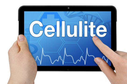 Tablet mit Touchscreen und Interface und Cellulite