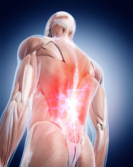 medical 3d illustration of a painful back