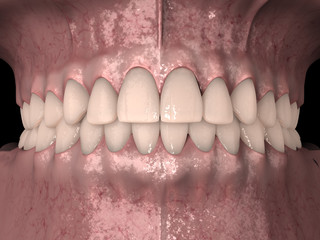 Anatomia dentale, arcata dentale superiore e inferiore con gengiva © lightmachine