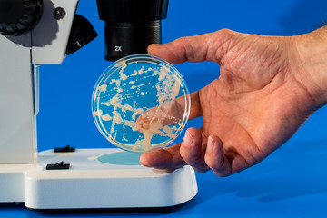 Laboratory doctor hand   holding petri dish with bacteria.