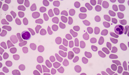 A blood smear is often used as a follow-up test to abnormal