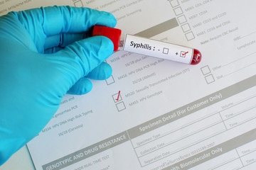 Sexually transmitted diseases: Syphilis