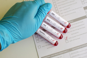 Sexually transmitted diseases: HIV, HBV, HCV, Syphilis