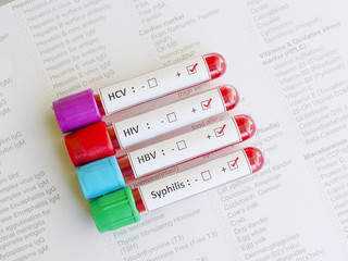 Sexually transmitted diseases: HIV, HBV, HCV, Syphilis