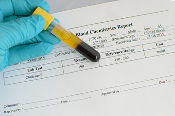 Normal lipid profile result