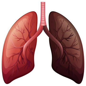 Lung cancer diagram in large scale Stock Vector | Adobe Stock