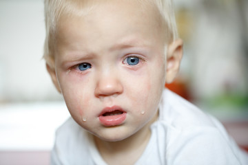 Small, crying toddler in pain