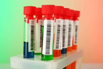 Test tubes with colorful liquid on light color background