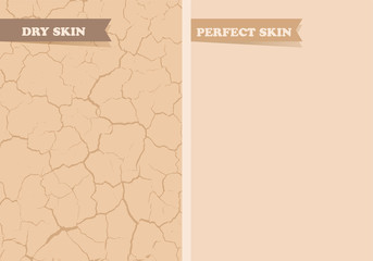 Dry skin, Perfect skin