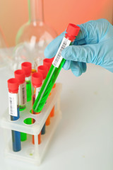 Test tubes with colorful liquid in scientist hand, closeup