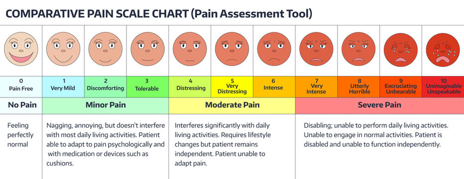 Intonation Pain Scale Lupon gov ph