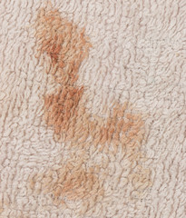 stain of blood on the terry cloth material