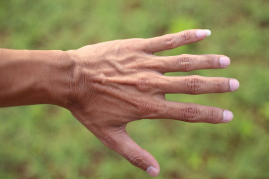Man's Hand