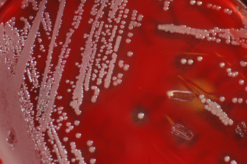 bacterial culture