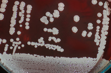 bacterial colonies