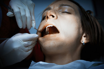 Dentist examining a patients teeth at the dental clinic.